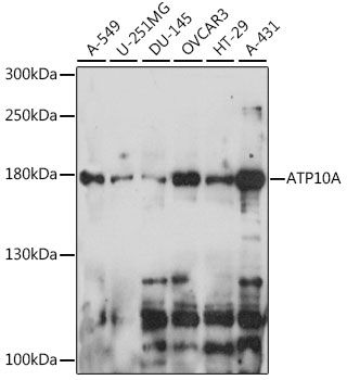Western blot - ATP10A antibody (144-015873)