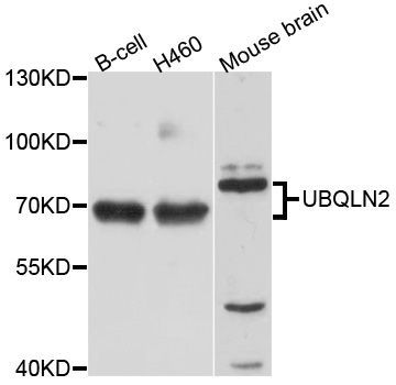 Western blot - UBQLN2 antibody (144-09568)