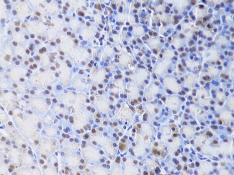 Immunofluorescence - XRCC4 Polyclonal Antibody (144-01677)