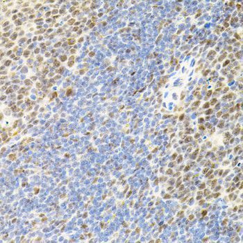 Immunohistochemistry - EIF4G2 antibody (144-02897)