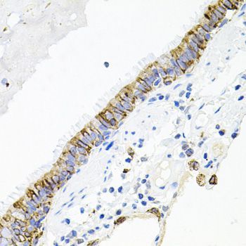 Immunohistochemistry - ACVR2A Polyclonal Antibody (144-01981)