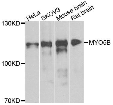 Western blot - MYO5B antibody (144-08558)