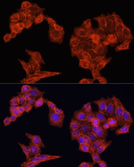 Immunohistochemistry - [KO Validated] EGFR Polyclonal Antibody (144-11351)
