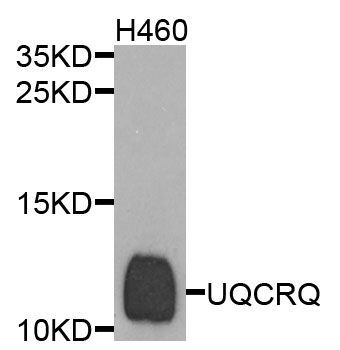 Western blot - UQCRQ antibody (144-09872)