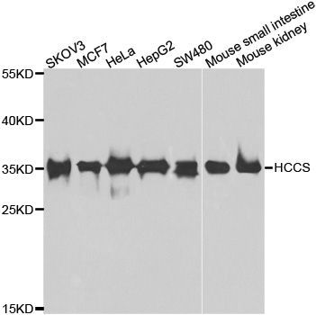 Western blot - HCCS antibody (144-07490)