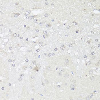 Western blot - CASP3 Polyclonal Antibody (144-02156)