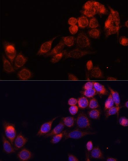 Immunofluorescence - SLC16A4 Polyclonal Antibody (144-60809)