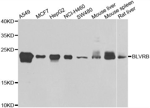 Western blot - BLVRB antibody (144-07260)