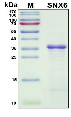 SDS-PAGE