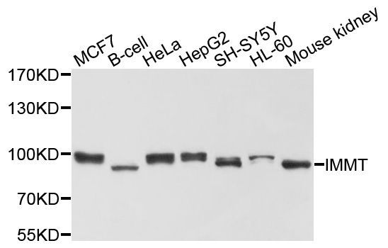 Western blot - IMMT Polyclonal Antibody (144-02751)
