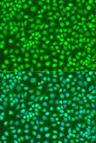 Immunofluorescence - IKBKB Polyclonal Antibody (144-00714)