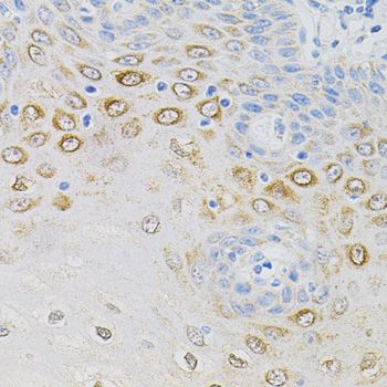 Immunohistochemistry - [KO Validated] GNA13 Polyclonal Antibody (144-05746)