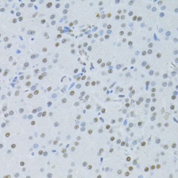 Immunohistochemistry - SNRNP70 antibody (144-06065)