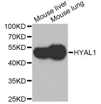 Western blot - HYAL1 Antibody (144-06623)
