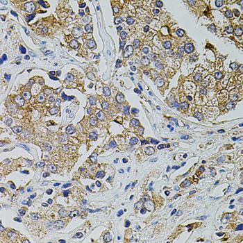 Immunohistochemistry - TRPA1 Polyclonal Antibody (144-08568)