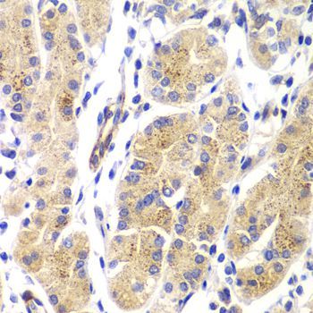 Immunohistochemistry - HRas Polyclonal Antibody (144-07901)