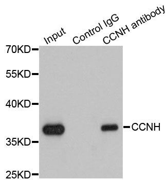 Immunoprecipitation - CCNH Polyclonal Antibody (144-00995)