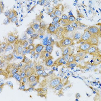 Immunohistochemistry - SIAH1 antibody (144-02494)