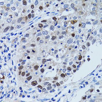 Immunohistochemistry - UHRF1 antibody (144-02343)