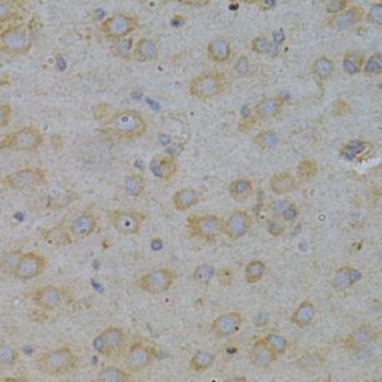 Immunohistochemistry - GGA2 Antibody (144-01186)