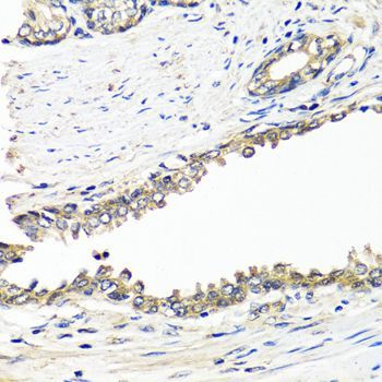 Immunohistochemistry - BRCA1 Polyclonal Antibody (144-00212)