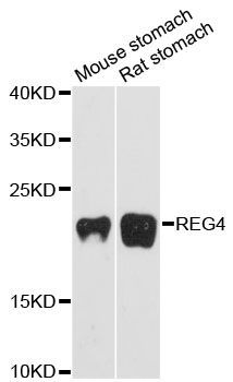 Western blot - REG4 antibody (144-60204)