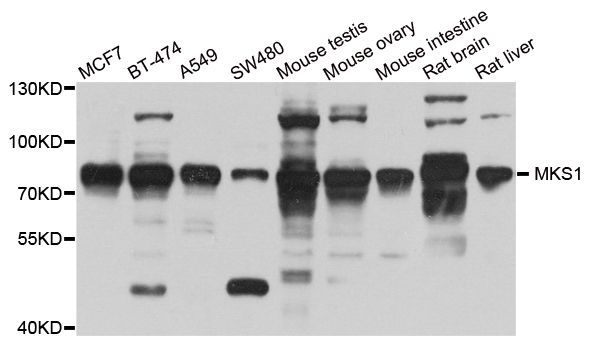 Western blot - MKS1 antibody (144-04802)