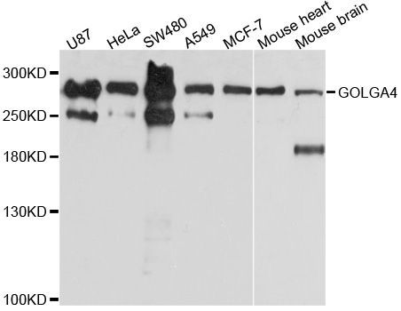 Western blot - GOLGA4 Polyclonal Antibody (144-010216)