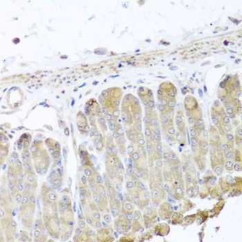 Immunohistochemistry - IRS2 antibody (144-07945)