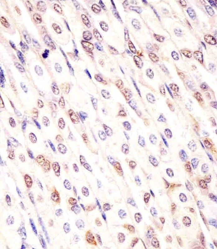 IHC-P