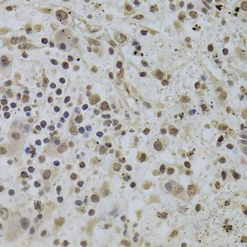 Immunohistochemistry - INTS6 Antibody (144-06634)