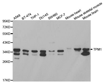 Western blot - TPM1 antibody (144-01157)