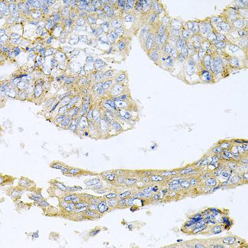 Immunohistochemistry - HDAC3 antibody (144-012542)