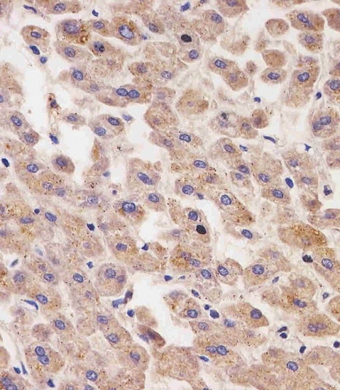 IHC-P