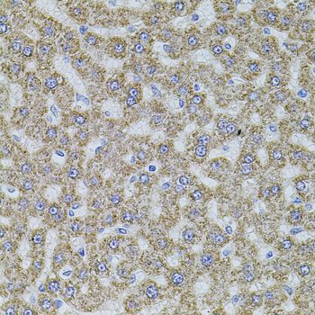 Immunohistochemistry - ALDH1A1 antibody (144-01802)