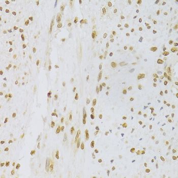 Immunohistochemistry - HMGB1 Polyclonal Antibody (144-02553)