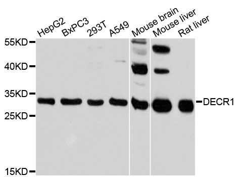 Western blot - DECR1 antibody (144-013014)