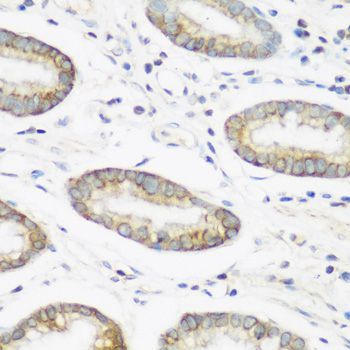 Immunohistochemistry - NEDD4 Polyclonal Antibody (144-00552)