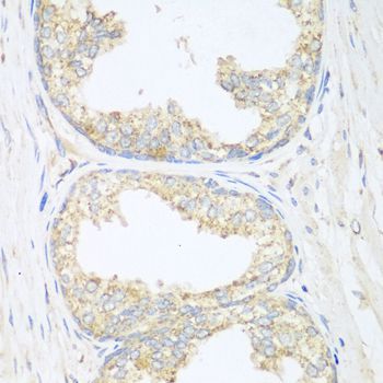 Immunohistochemistry - SGCB antibody (144-06979)