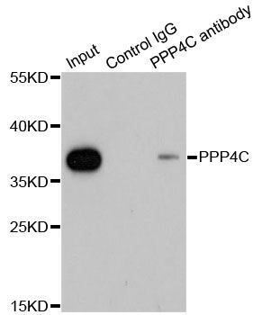 Immunoprecipitation - 1ug PPP4C antibody (144-60378)