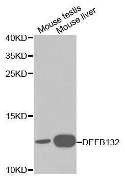 Western blot - DEFB132 Polyclonal Antibody (144-01074)