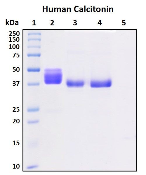 SDS-PAGE