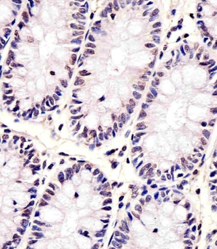 IHC-P