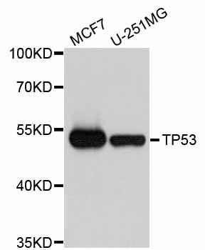 Western blot - TP53 Polyclonal Antibody (144-00263)