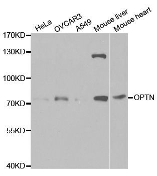 Western blot - OPTN antibody (144-01845)