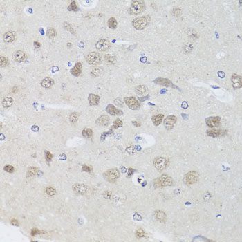 Immunohistochemistry - [KO Validated] PPP1CC Polyclonal Antibody (144-04035)