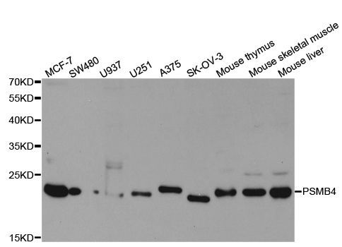 Western blot - PSMB4 Polyclonal Antibody (144-05697)
