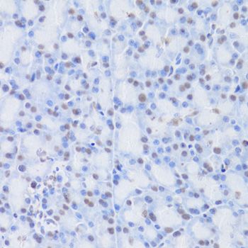 Immunohistochemistry - CBX8 Polyclonal Antibody (144-06222)