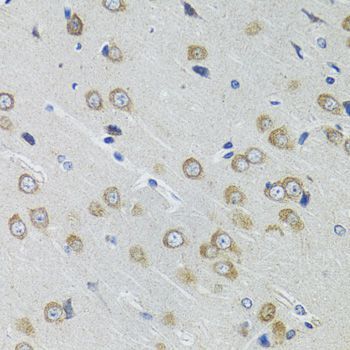 Immunohistochemistry - IKBKG Polyclonal Antibody (144-00917)