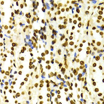 Immunohistochemistry - DiMethyl-Histone H3-K27 pAb (144-02362)